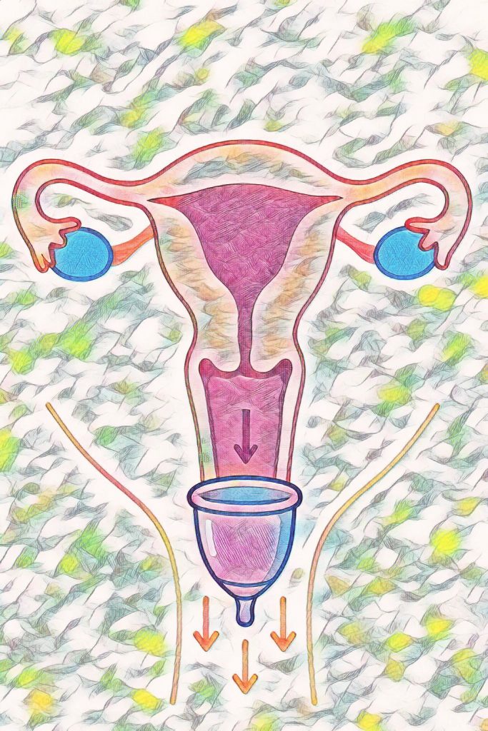 kleurijke schematische illustratie van baarmoeder,eierstokken en vagina gezien van voor. Met in de vagina naar beneden glijdende menstruatiecup